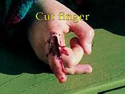 Cut Finger