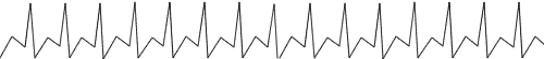 Normal heartbeat